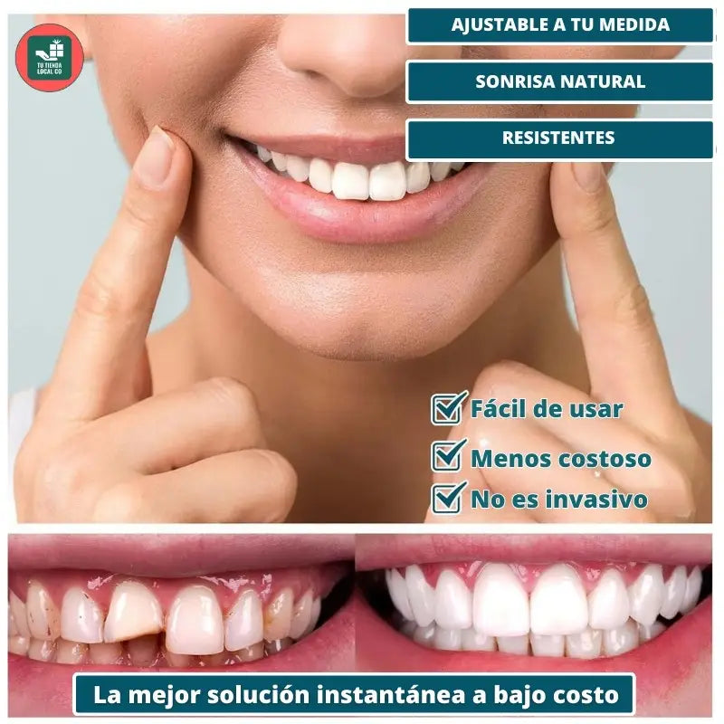 CARILLAS DENTALES GG SNAP ON DENTURE UN CAMBIO QUE TRANSFORMA TU VIDA AL INSTANTE